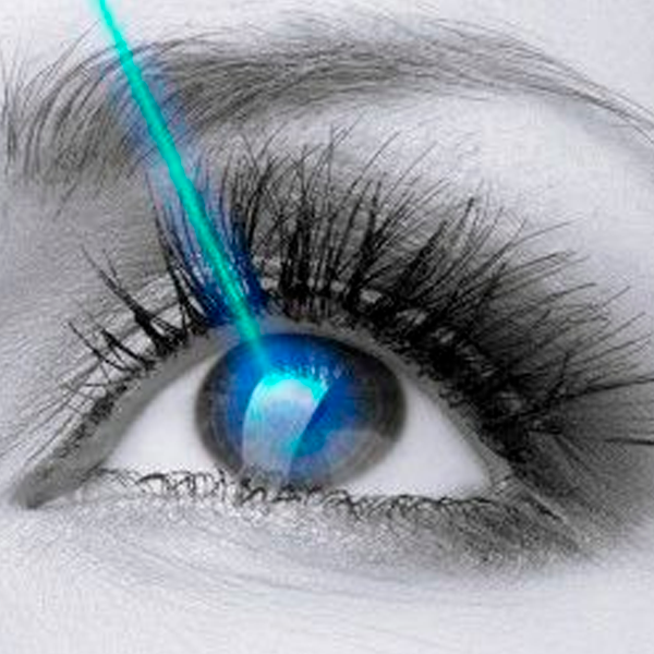 Cirugía-refractiva-(LASIK)